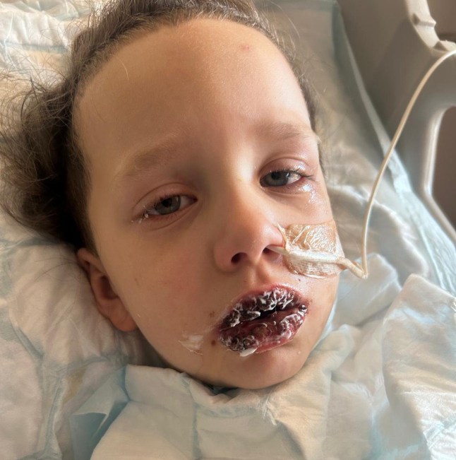 Rachel Tompkins ATT - Elaine Adams: Docs thought was Hand Foot and Mouth - but rare condition could have blinded my son