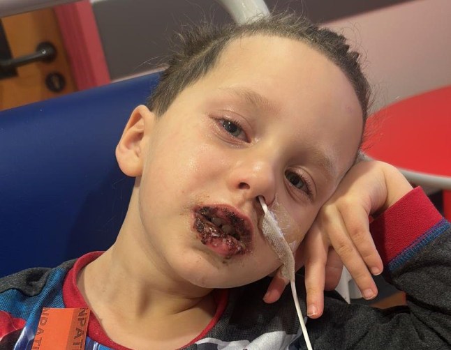 Rachel Tompkins ATT - Elaine Adams: Docs thought was Hand Foot and Mouth - but rare condition could have blinded my son